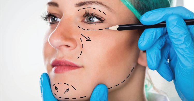 Face Liposuction