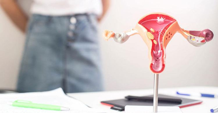 PCOD PCOS Treatment